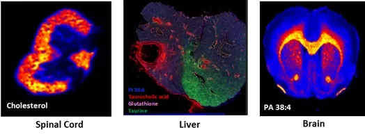 DESI mass spectrometry imaging of spinal cord, liver, and brain tissue showing spatial distribution of lipids and metabolites